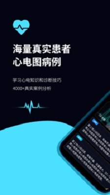 心电图ECG安卓版